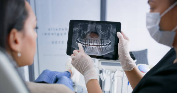 Licensed Wisdom Tooth Removal service in Hutchinson County County, SD - Smile Center Dentistry